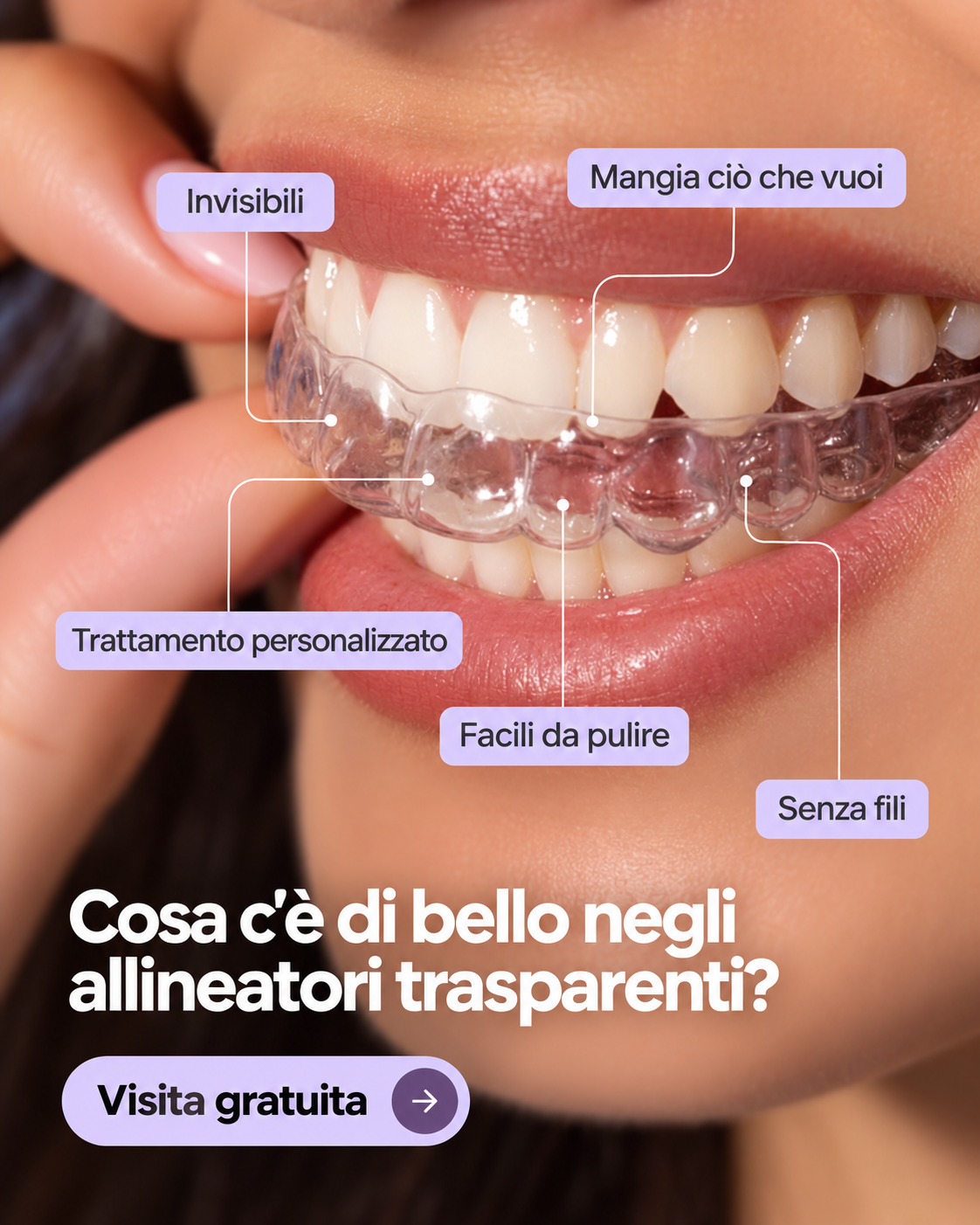 Sorriso dritto, senza fili